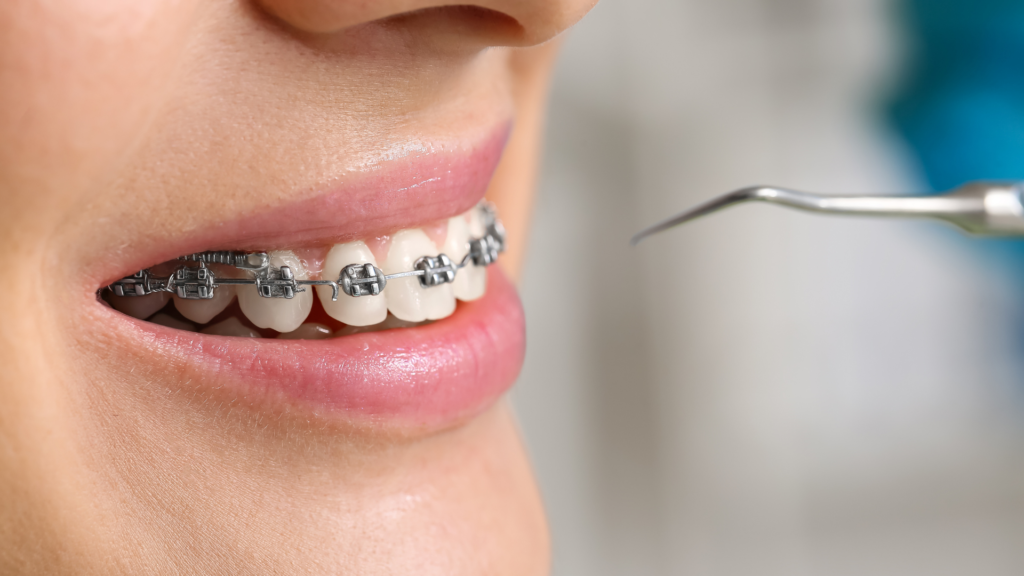 dentista en casarrubuelos